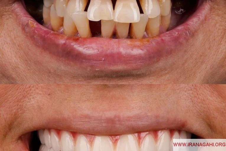 خدمات زیبایی دندانپزشکی اقساطی 