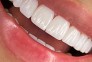 خدمات زیبایی دندانپزشکی اقساطی 