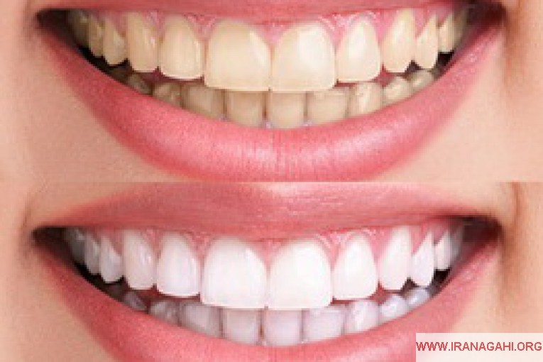 مطب دندانپزشکی زیبایی