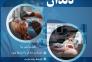 ایمپلنت دندان در مشهد – از دم قسط، بدون سود و بهره!>